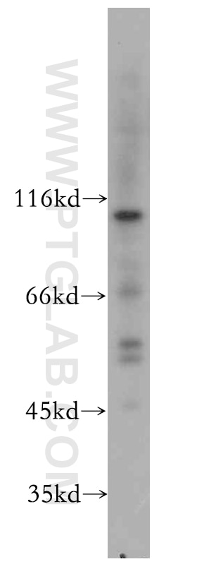 Western Blot (WB) analysis of K-562 cells using MUTYH Polyclonal antibody (19650-1-AP)