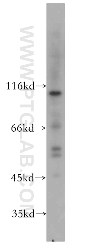 WB analysis of K-562 using 19650-1-AP