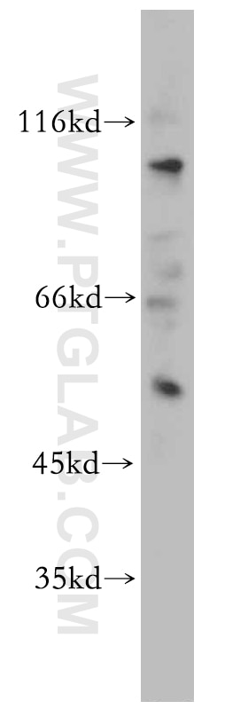Western Blot (WB) analysis of Raji cells using MUTYH Polyclonal antibody (19650-1-AP)