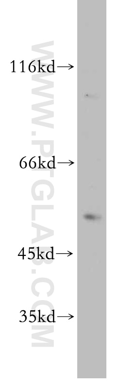 Western Blot (WB) analysis of COLO 320 cells using MUTYH Polyclonal antibody (19650-1-AP)