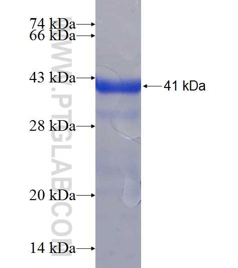 MUTYH fusion protein Ag7526 SDS-PAGE