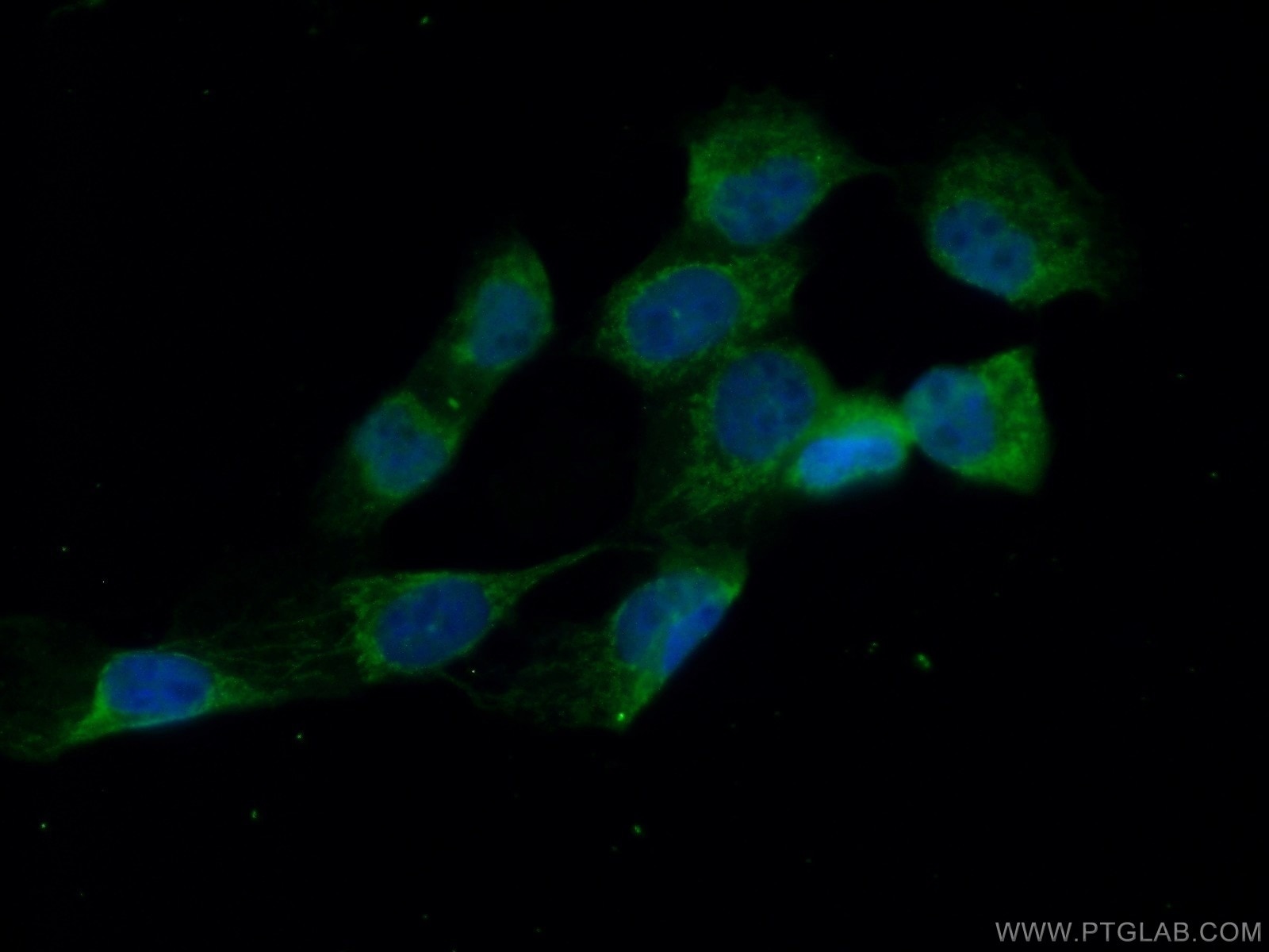 Immunofluorescence (IF) / fluorescent staining of A431 cells using MVD Polyclonal antibody (15331-1-AP)