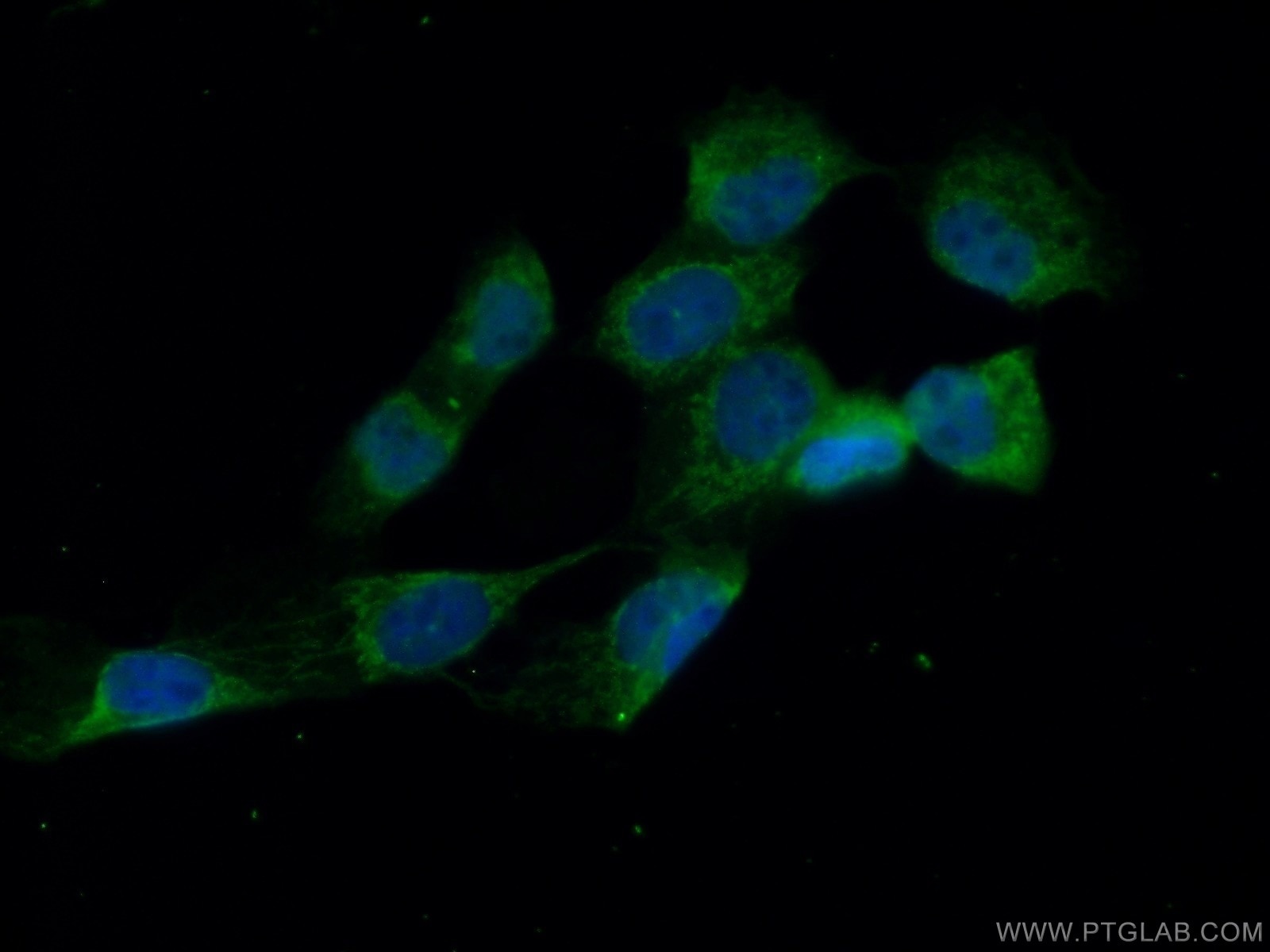 IF Staining of A431 using 15331-1-AP