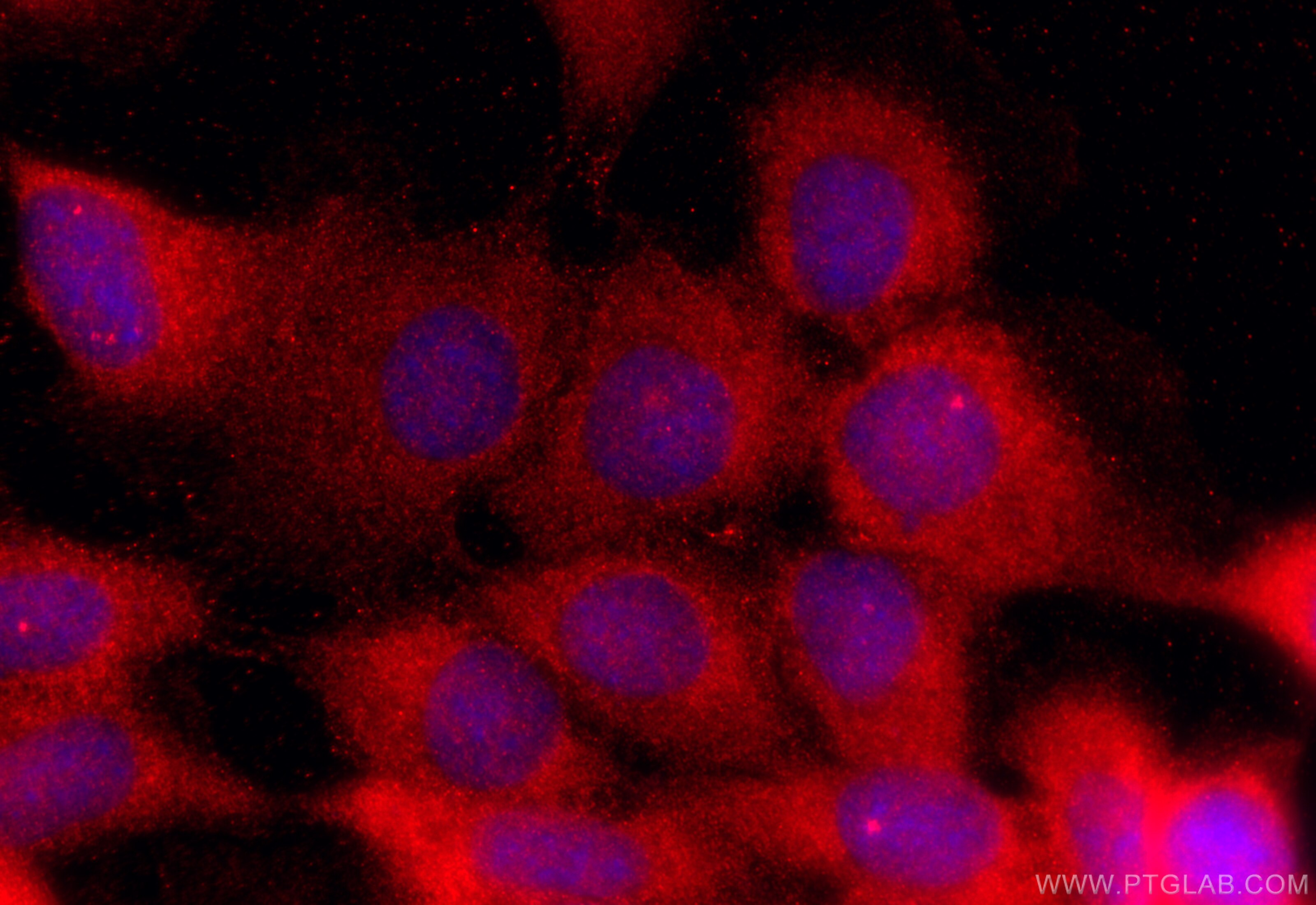 Immunofluorescence (IF) / fluorescent staining of A431 cells using MVD Polyclonal antibody (15331-1-AP)