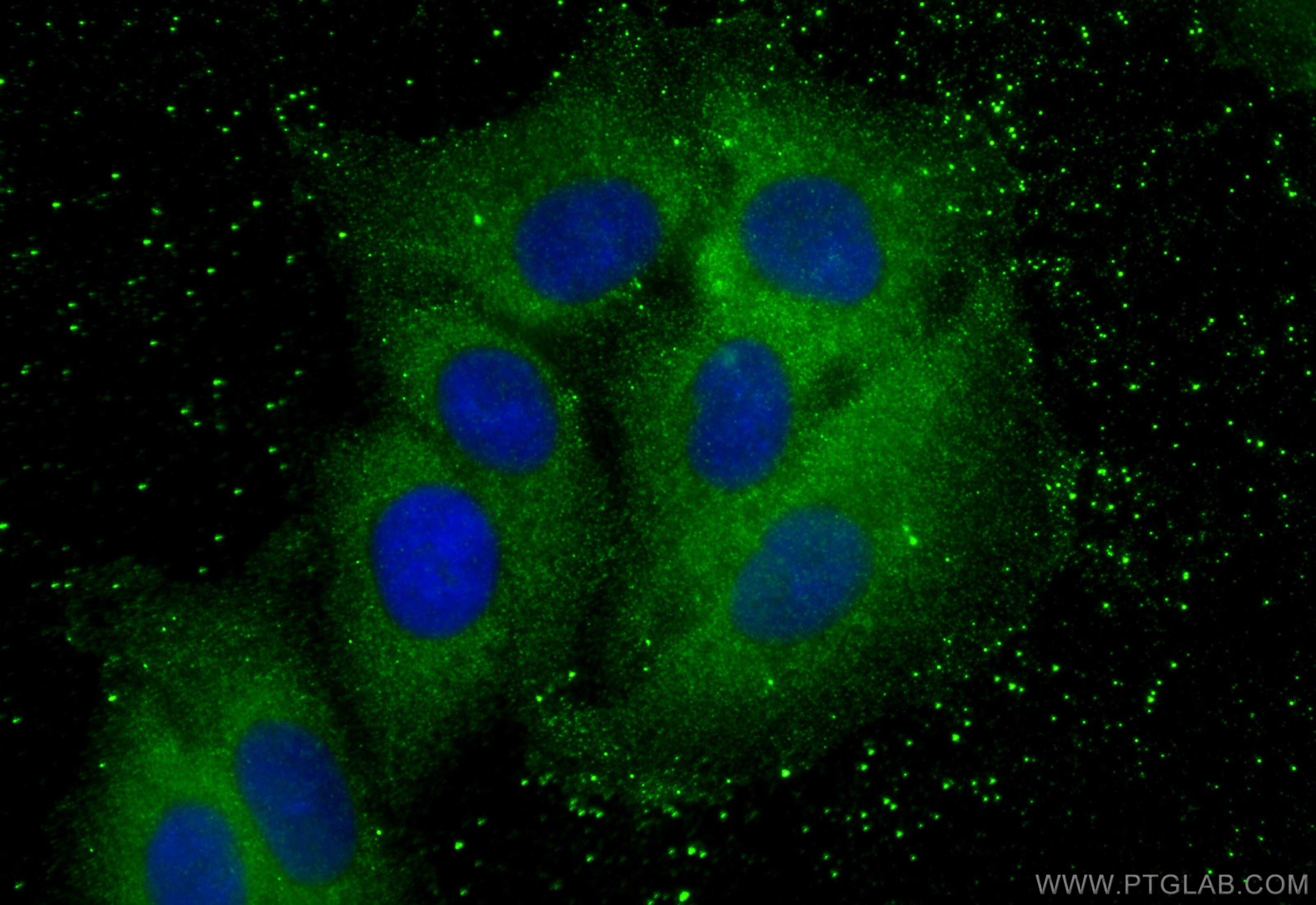 Immunofluorescence (IF) / fluorescent staining of A549 cells using MVD Polyclonal antibody (15331-1-AP)