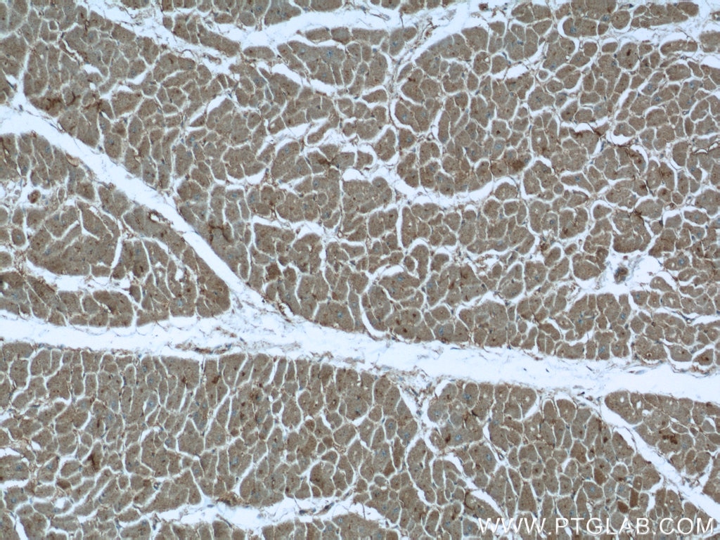 Immunohistochemistry (IHC) staining of human heart tissue using MVD Polyclonal antibody (15331-1-AP)