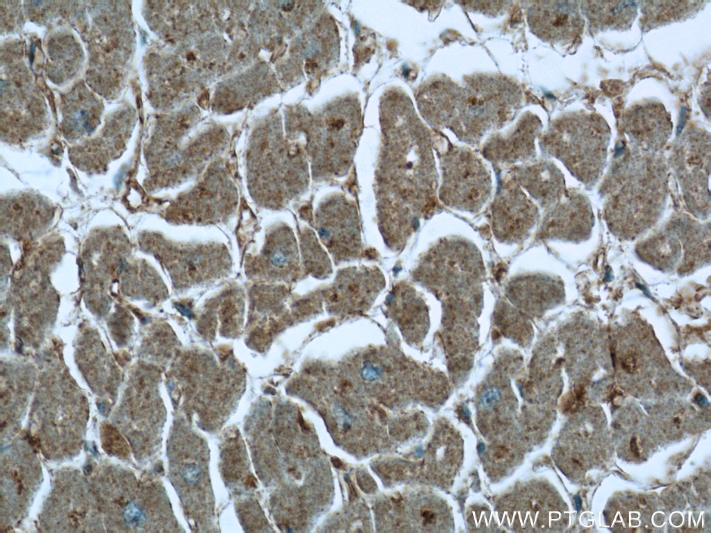 Immunohistochemistry (IHC) staining of human heart tissue using MVD Polyclonal antibody (15331-1-AP)