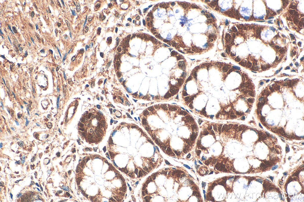 Immunohistochemistry (IHC) staining of human colon tissue using MVD Polyclonal antibody (15331-1-AP)