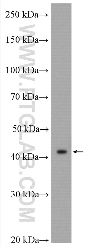 Western Blot (WB) analysis of HepG2 cells using MVD Polyclonal antibody (15331-1-PBS)