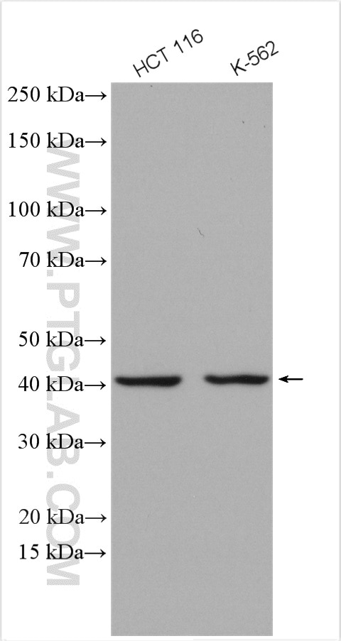 Western Blot (WB) analysis of various lysates using MVD Polyclonal antibody (15331-1-AP)