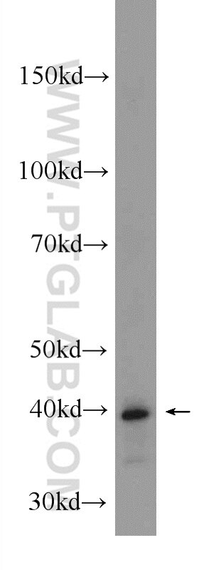 Western Blot (WB) analysis of rat liver tissue using MVD Polyclonal antibody (15331-1-AP)