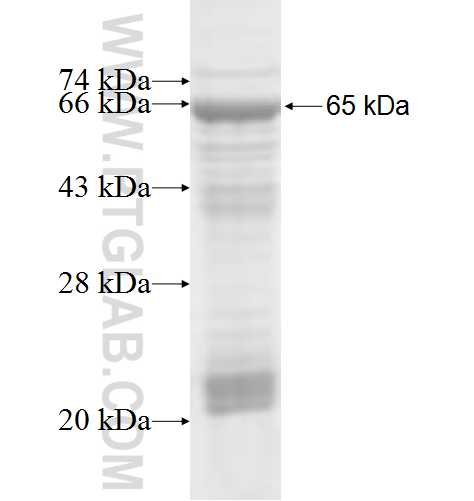 MVD fusion protein Ag7255 SDS-PAGE