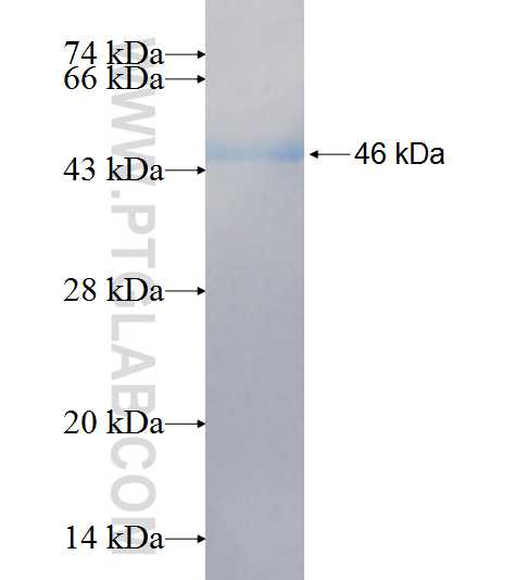 MVD fusion protein Ag7576 SDS-PAGE