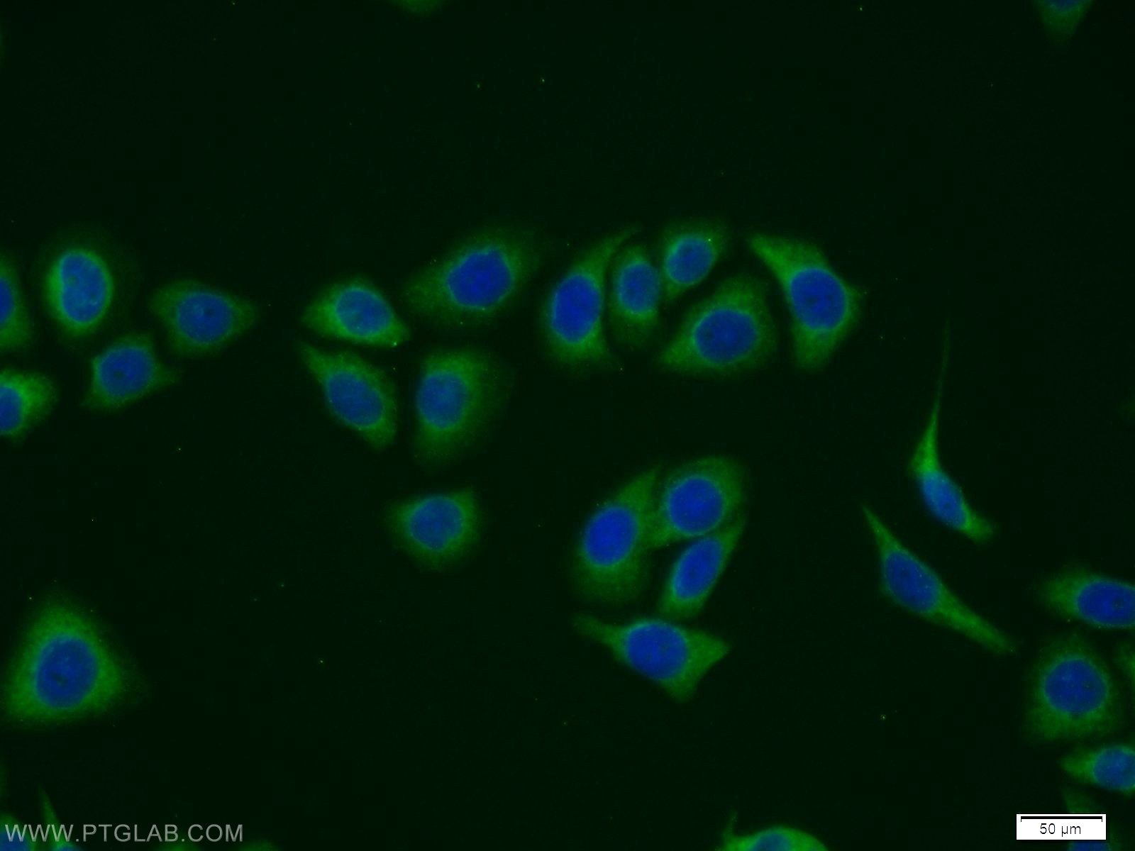 IF Staining of PC-3 using 12228-1-AP