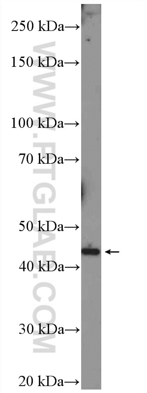 Western Blot (WB) analysis of mouse uterus tissue using MVK Polyclonal antibody (12228-1-AP)