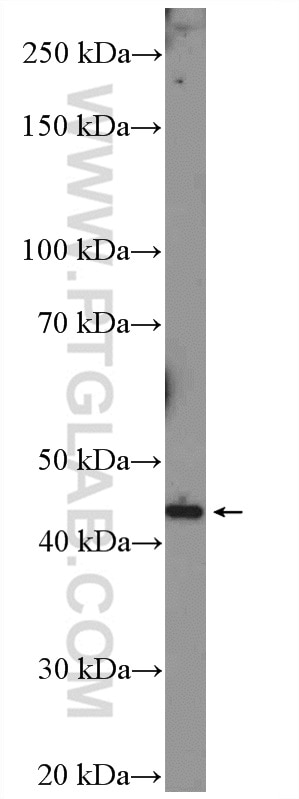 WB analysis of mouse uterus using 12228-1-AP