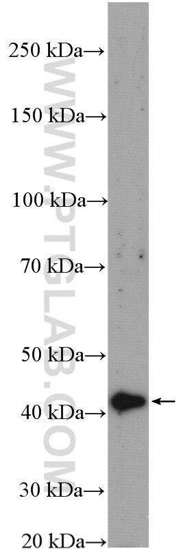 Western Blot (WB) analysis of mouse uterus tissue using MVK Polyclonal antibody (12228-1-AP)