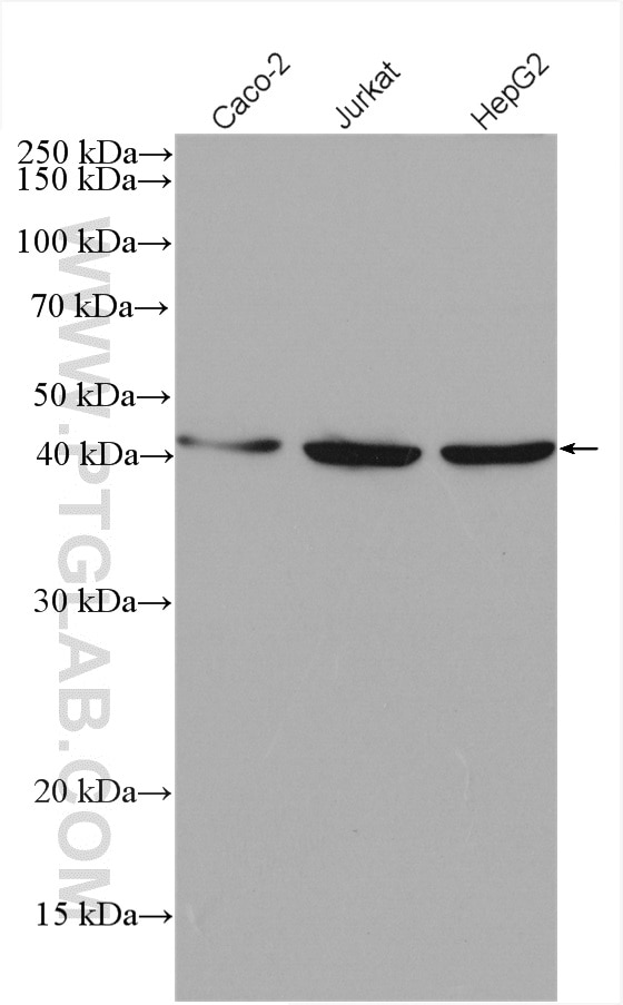 Western Blot (WB) analysis of various lysates using MVK Polyclonal antibody (12228-1-AP)