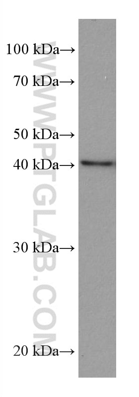 Western Blot (WB) analysis of U2OS cells using MVK Monoclonal antibody (67820-1-Ig)