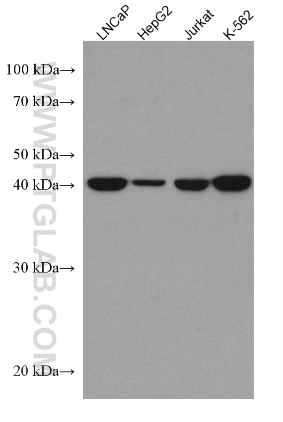Western Blot (WB) analysis of various lysates using MVK Monoclonal antibody (67820-1-Ig)