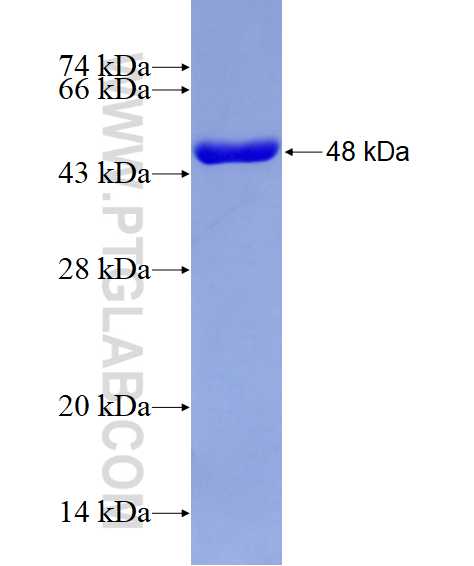 MVK fusion protein Ag28887 SDS-PAGE