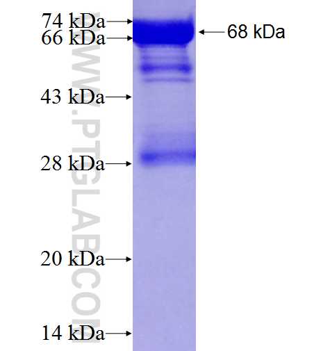 MVK fusion protein Ag2865 SDS-PAGE