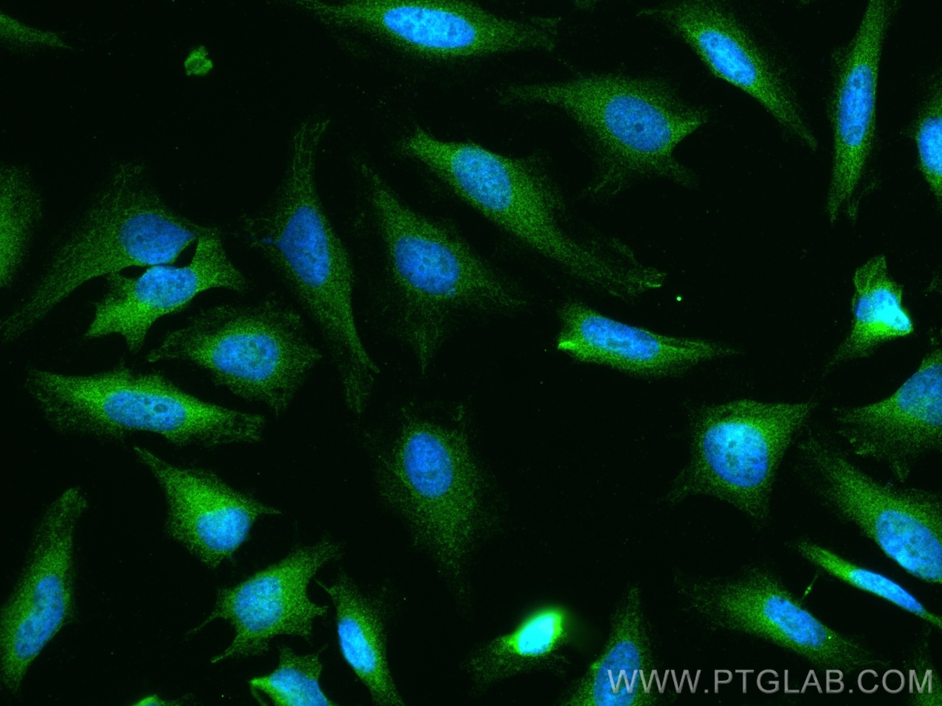 Immunofluorescence (IF) / fluorescent staining of HeLa cells using MVP/LRP Polyclonal antibody (16478-1-AP)