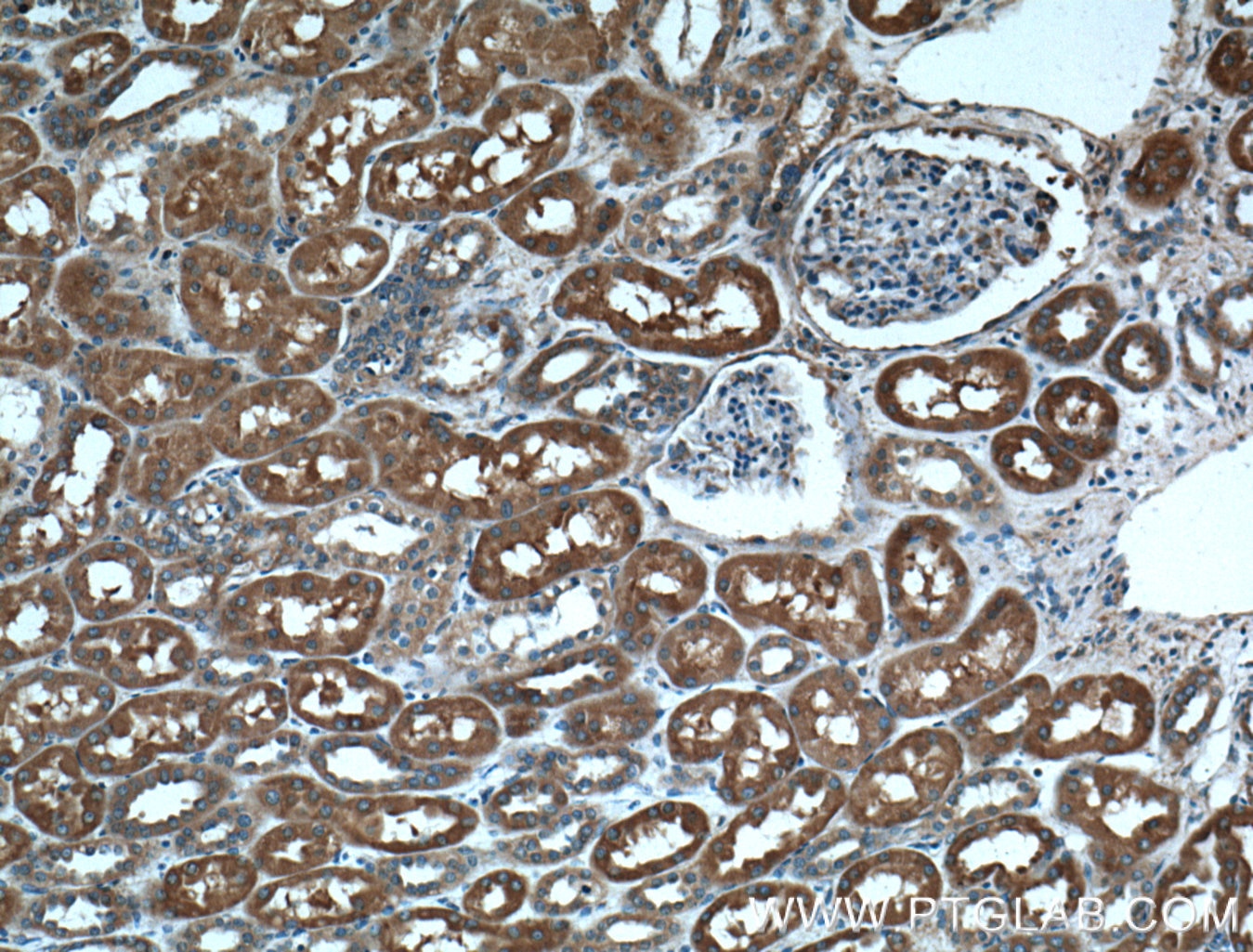 Immunohistochemistry (IHC) staining of human kidney tissue using MVP/LRP Polyclonal antibody (16478-1-AP)