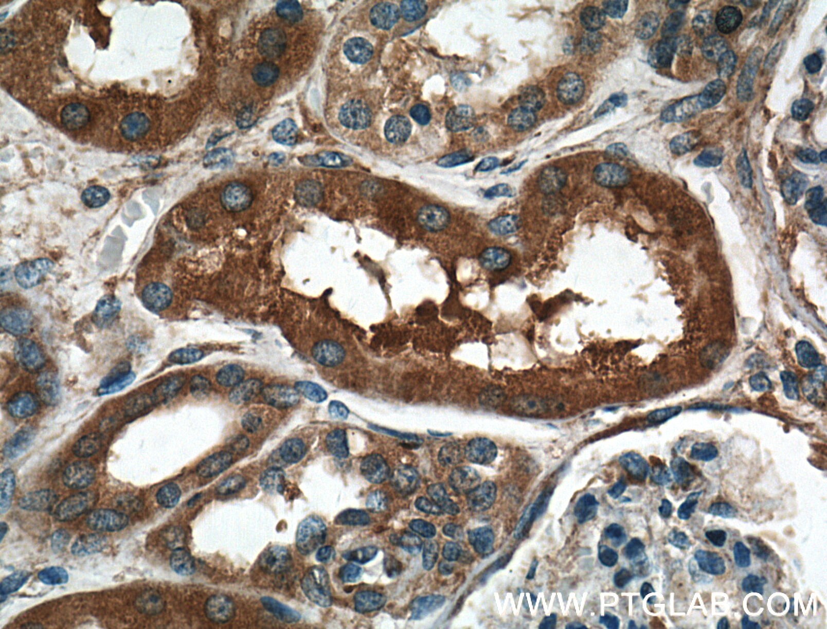 Immunohistochemistry (IHC) staining of human kidney tissue using MVP/LRP Polyclonal antibody (16478-1-AP)