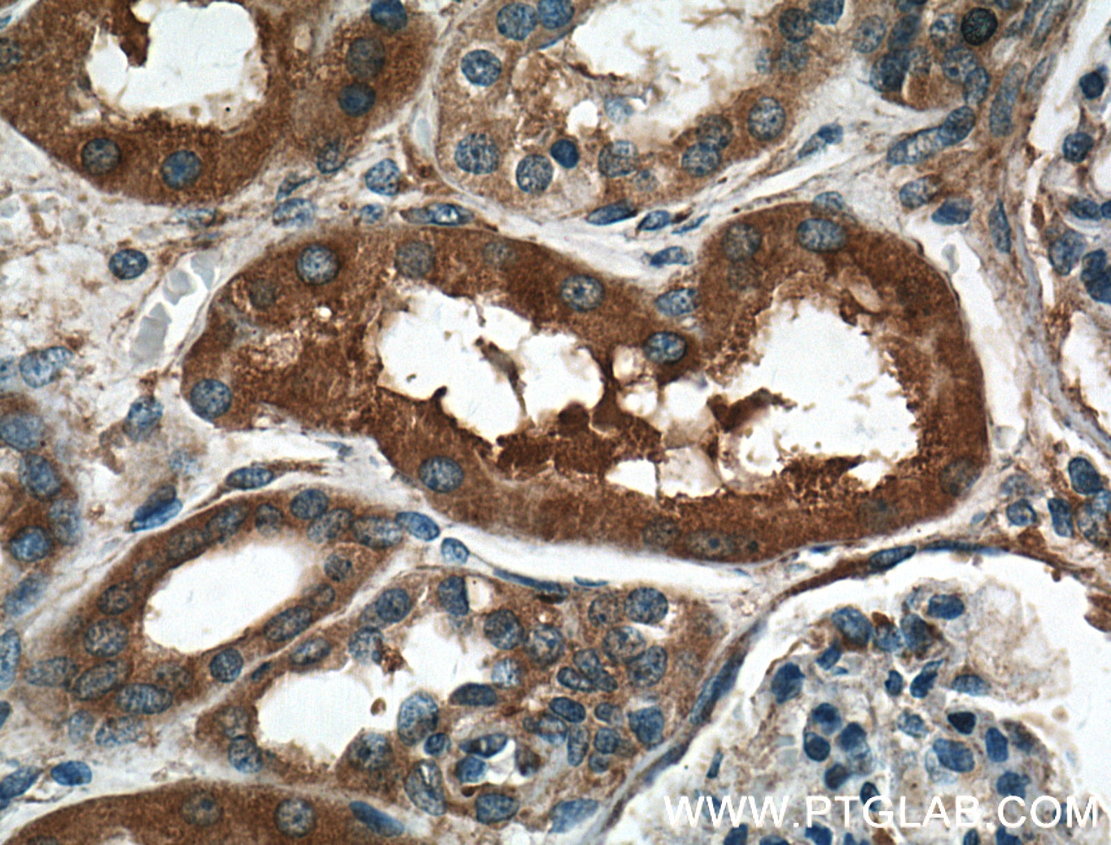 IHC staining of human kidney using 16478-1-AP