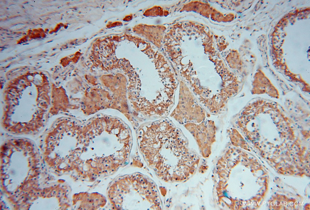 Immunohistochemistry (IHC) staining of human testis tissue using MVP/LRP Polyclonal antibody (16478-1-AP)