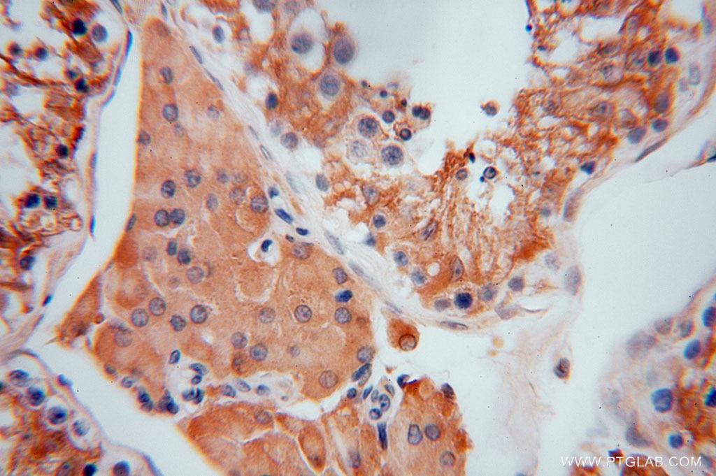 Immunohistochemistry (IHC) staining of human testis tissue using MVP/LRP Polyclonal antibody (16478-1-AP)