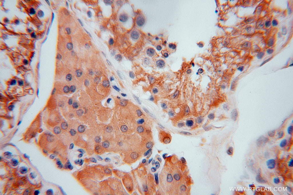 IHC staining of human testis using 16478-1-AP