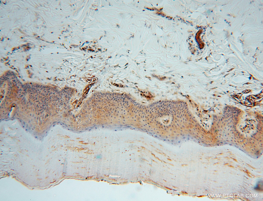 Immunohistochemistry (IHC) staining of human skin tissue using MVP/LRP Polyclonal antibody (16478-1-AP)