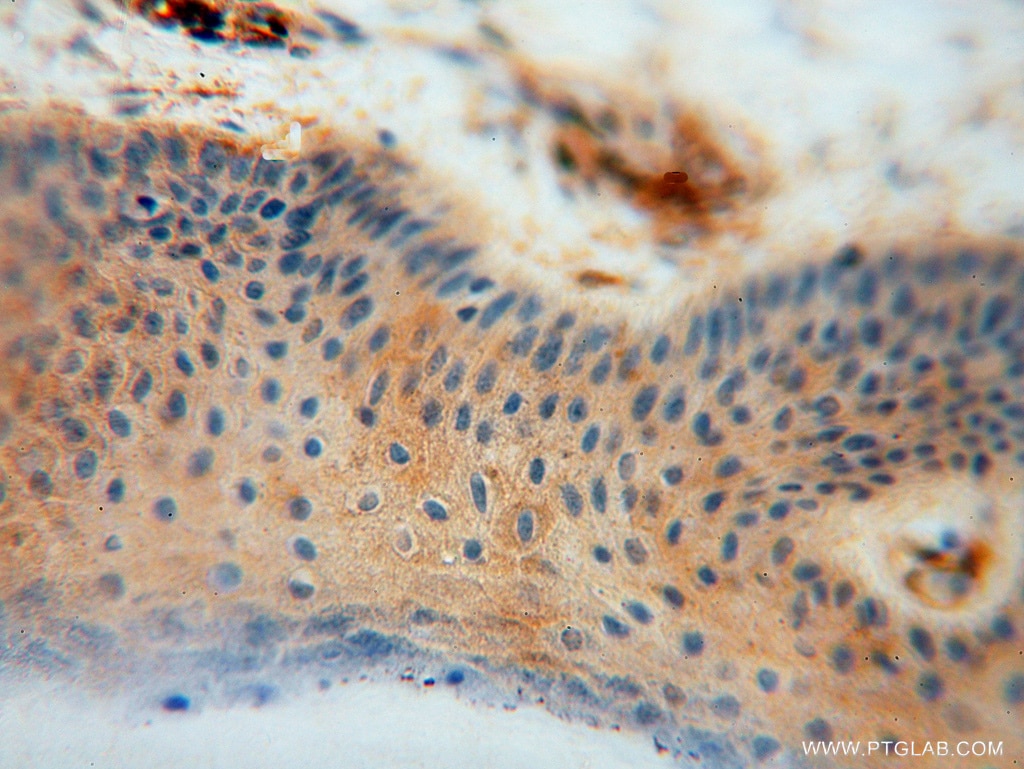 Immunohistochemistry (IHC) staining of human skin tissue using MVP/LRP Polyclonal antibody (16478-1-AP)