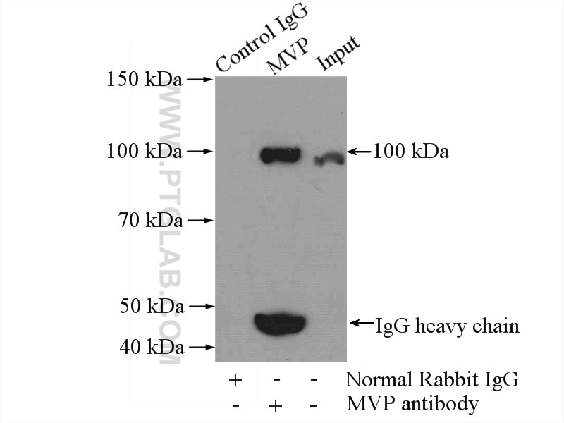 Immunoprecipitation (IP) experiment of mouse lung tissue using MVP/LRP Polyclonal antibody (16478-1-AP)