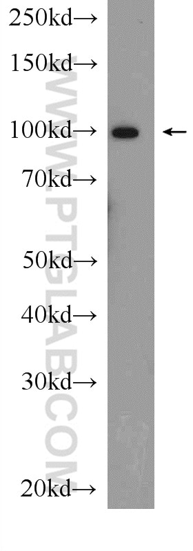 Western Blot (WB) analysis of mouse lung tissue using MVP/LRP Polyclonal antibody (16478-1-AP)