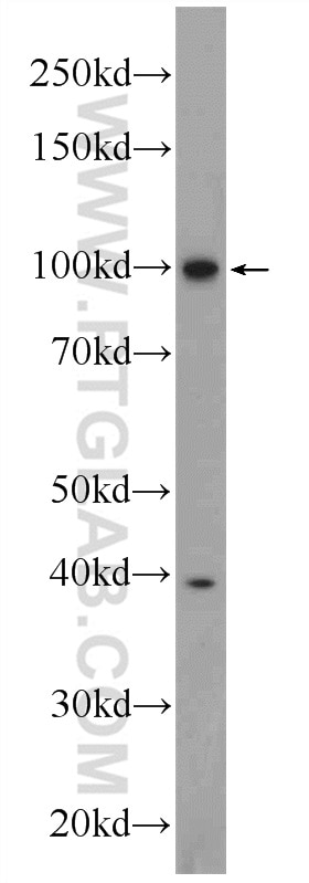 Western Blot (WB) analysis of rat lung tissue using MVP/LRP Polyclonal antibody (16478-1-AP)