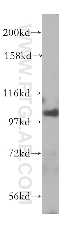 Western Blot (WB) analysis of human brain tissue using MVP/LRP Polyclonal antibody (16478-1-AP)