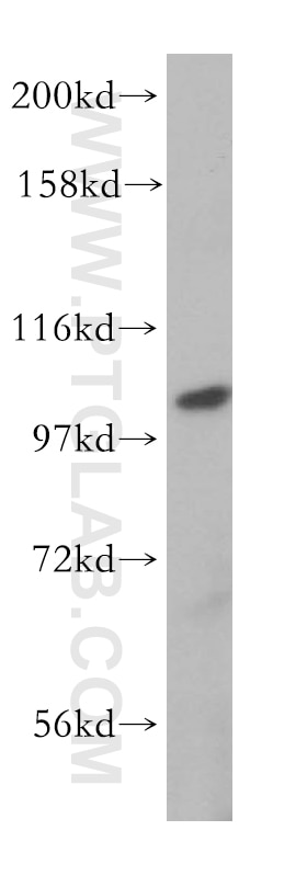 MVP/LRP Polyclonal antibody