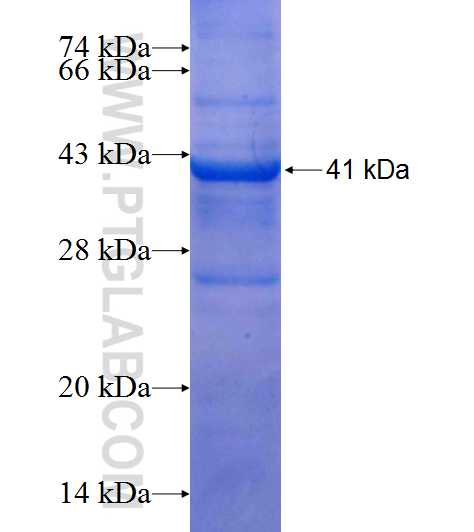 MVP fusion protein Ag9593 SDS-PAGE