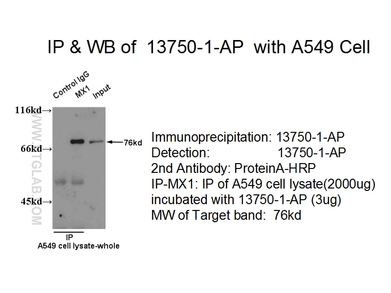 Immunoprecipitation (IP) experiment of A549 cells using MX1 Polyclonal antibody (13750-1-AP)