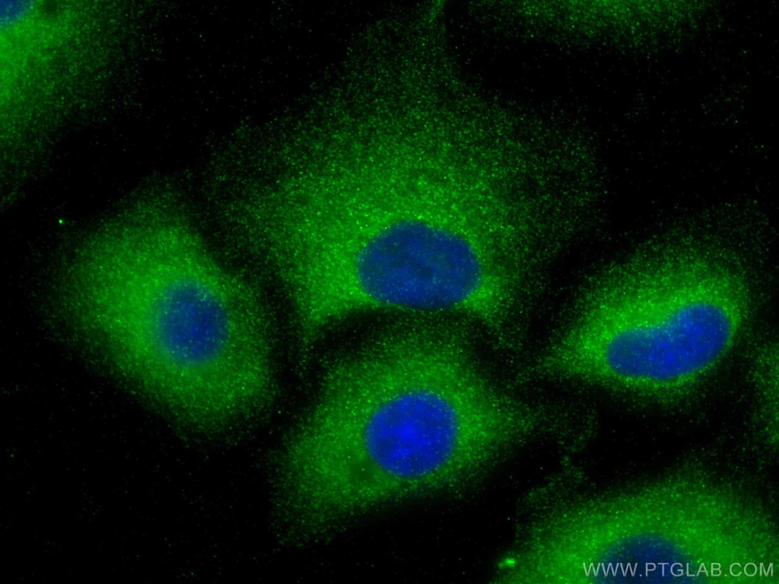 Immunofluorescence (IF) / fluorescent staining of A549 cells using MX1 Polyclonal antibody (13750-1-AP)