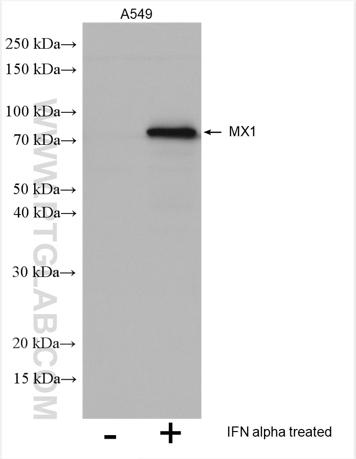 Western Blot (WB) analysis of various lysates using MX1 Polyclonal antibody (13750-1-AP)