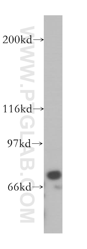 Western Blot (WB) analysis of mouse lung tissue using MX1 Polyclonal antibody (13750-1-AP)