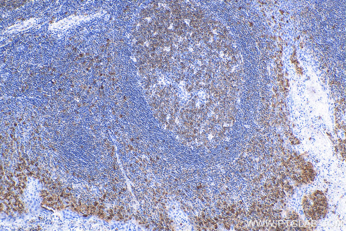 Immunohistochemistry (IHC) staining of human tonsillitis tissue using MX1 Recombinant antibody (82677-1-RR)