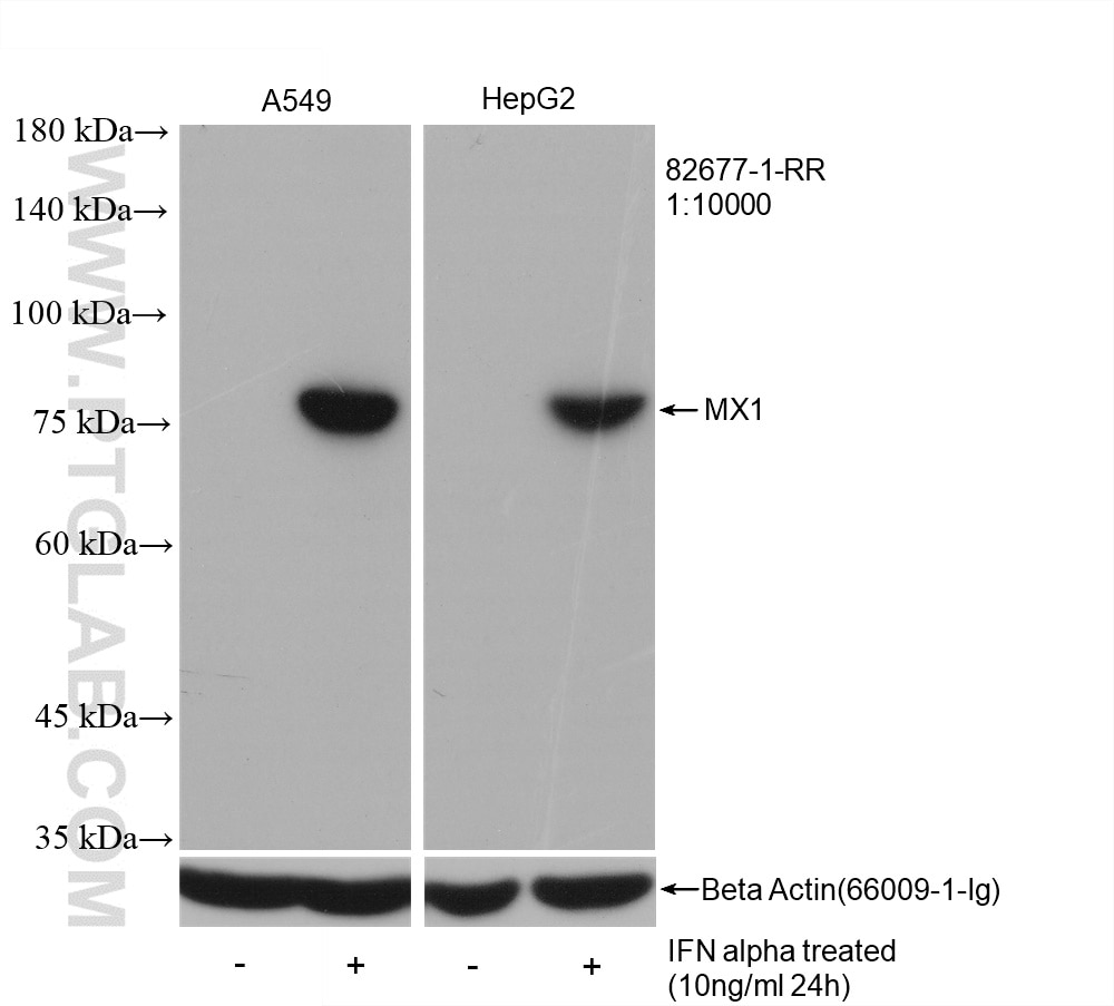 Western Blot (WB) analysis of various lysates using MX1 Recombinant antibody (82677-1-RR)