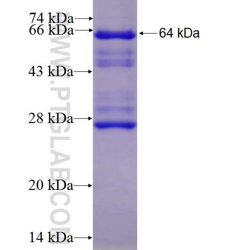 MX1 fusion protein Ag4692 SDS-PAGE
