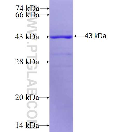 MX1 fusion protein Ag4862 SDS-PAGE