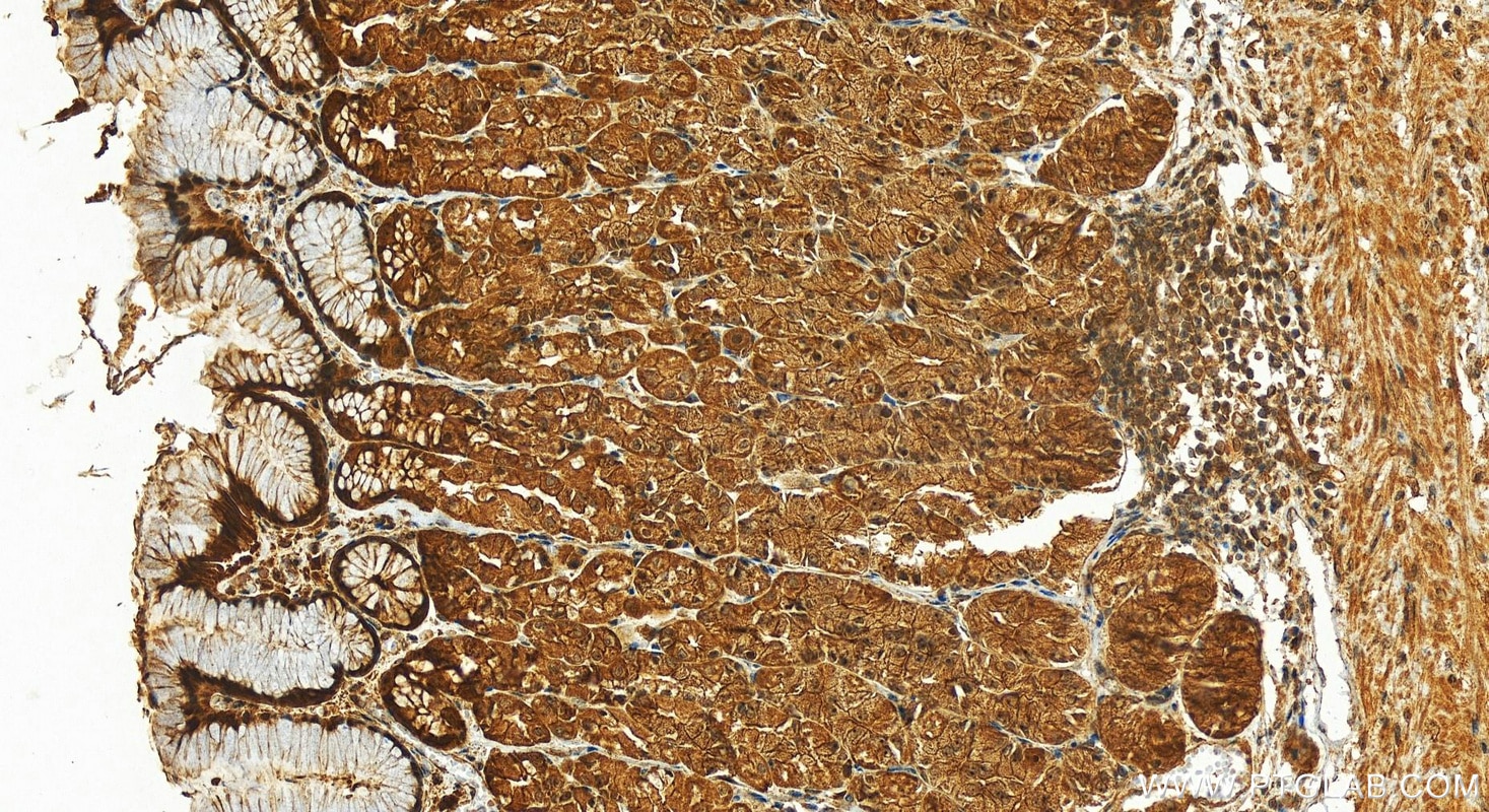 Immunohistochemistry (IHC) staining of human stomach tissue using MX2 Polyclonal antibody (13278-1-AP)